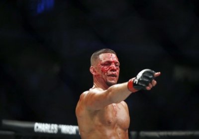 UFC жангчиси Нейт Диас Конор Макгрегорга қарши жангдан сўнг марихуана истеъмол қилгани учун жазоланмайди фото